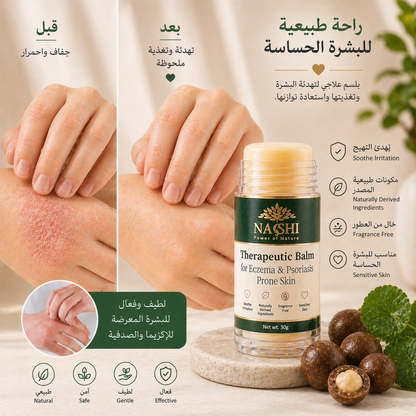 Balm for Eczema & Psoriasis