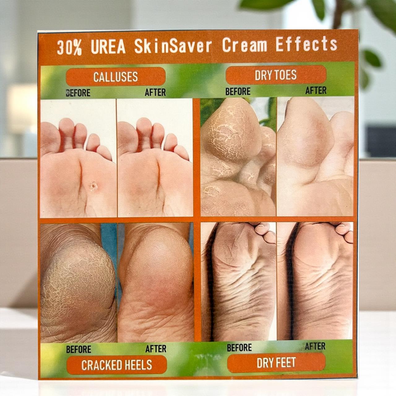30% UREA SkinSaver Foot Cream